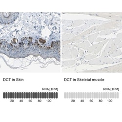 Tyrosylprotein Sulfotransferase 2/TPST2 Antibody, Novus Biologicals:Antibodies:Primary